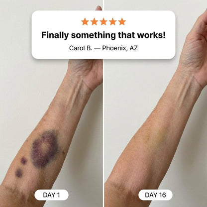💥100K+ SOLD💕- LIMETOW® Bruise Repair & Skin-Strengthening Cream